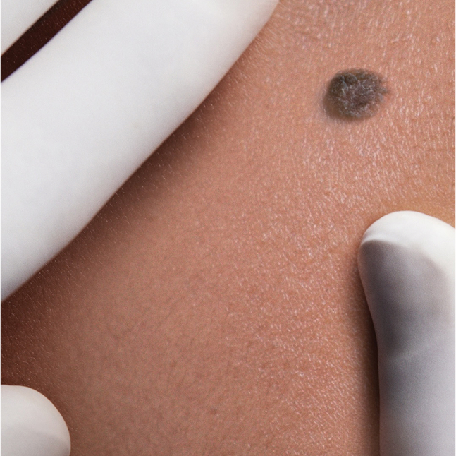 Skin Program Image